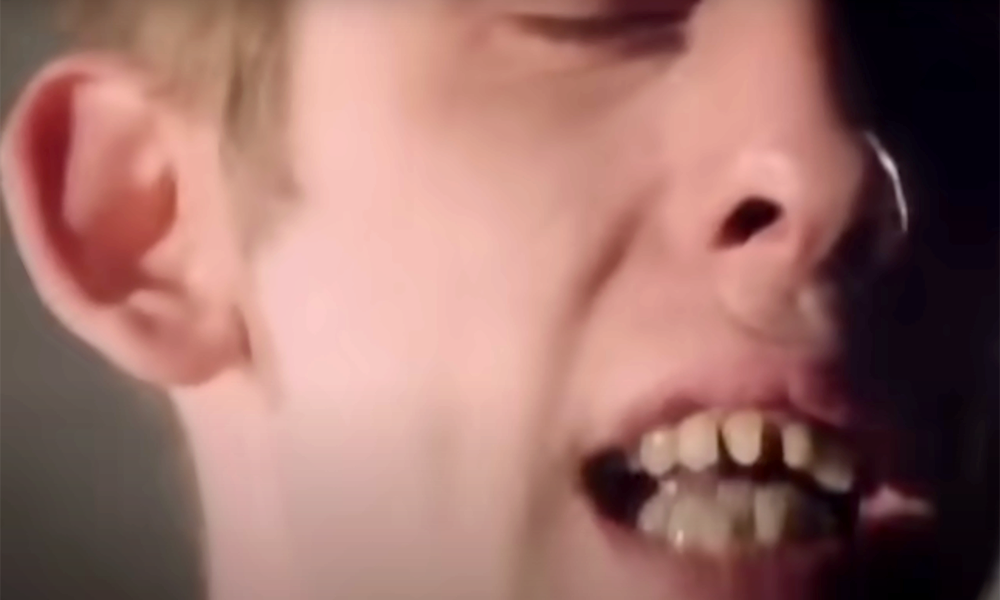 I’ll never forget the first time I saw Shane MacGowan’s teeth